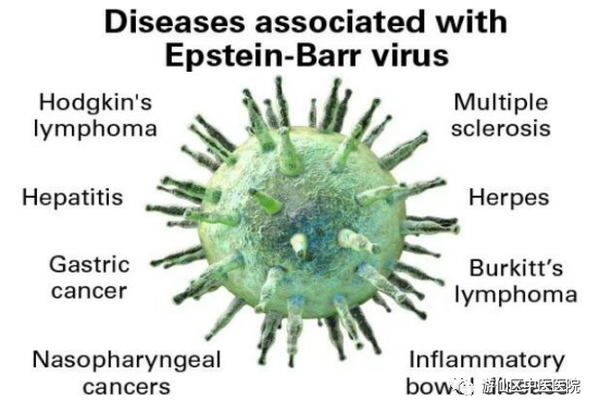 游仙分院：发烧、咽痛、淋巴结肿大，警惕EB病毒感染！