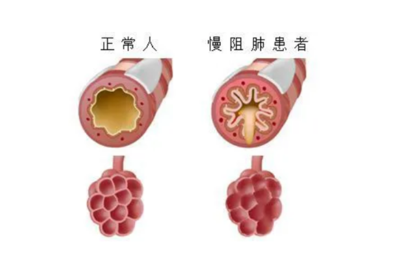 图片14-2.png 图片14-2.png