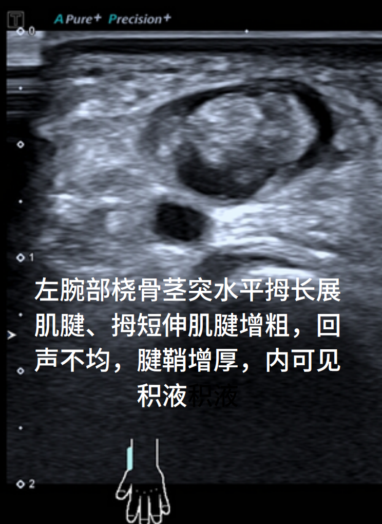 微信图片_20251201200723_15_326.png 微信图片_20251201200723_15_326.png